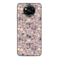 Xiaomi Redmi Poco X3 Uyumlu Kılıf Romans (32) Soft Silikon Kılıf Taş