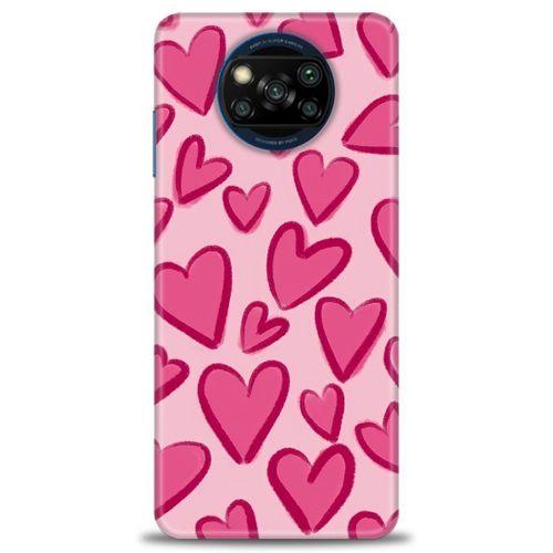 Xiaomi Poco X3 NFC Kılıf HD Baskılı Kılıf - Pembe Kalp + Tam Ekran Koruyucu