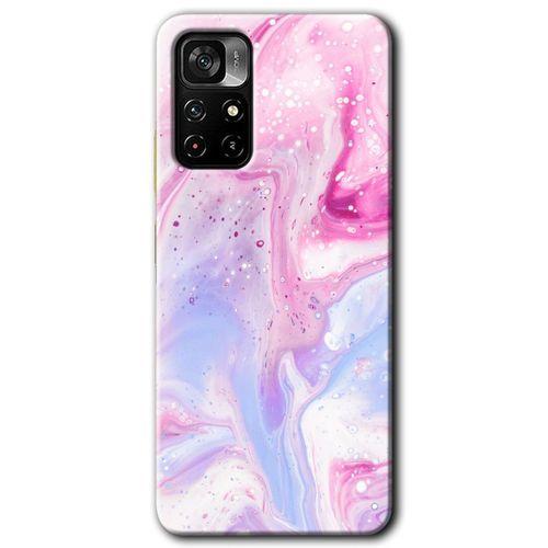 Poco M4 Pro 5G Kılıf HD Desen Baskılı Arka Kapak - Kabarmış Leke + Kırılmaz Cam