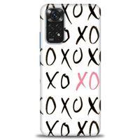Xiaomi Redmi Note 11 Kılıf HD Baskılı Kılıf - XOXO + Tam Ekran Koruyucu
