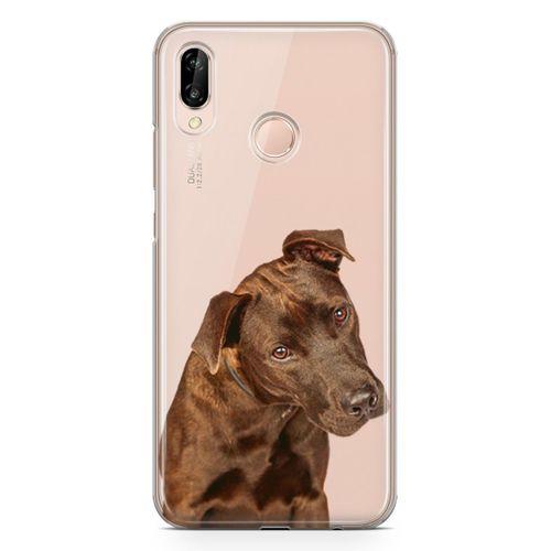 Huawei P20 Lite Kılıf Labrador Retriever Arka Kapak Koruma Desenli Full Koruyucu