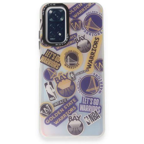 Xiaomi Redmi Note 11 Kılıf Estoril Desenli Kapak