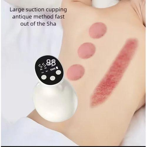 Sıcaklık Emişli Bardak Çekme Terapisi, Vakumlu Masaj Aleti,Terapi Cihazı Masaj Cihazı