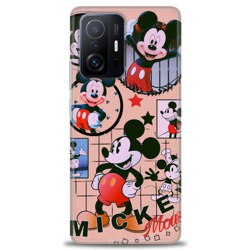 Xiaomi Mi 11T Kılıf HD Baskılı Kılıf - Mickey Mouse + Tam Ekran Koruyucu