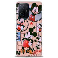 Xiaomi Mi 11T Kılıf HD Baskılı Kılıf - Mickey Mouse + Tam Ekran Koruyucu