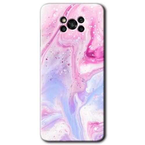 MRCİLETİSİM Poco x3 Pro Kılıf Kapak - Kabarmış Leke +Hayalet Ekran Yandan Gözükmez