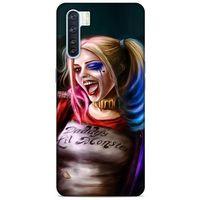 Oppo A91 Uyumlu Kılıf Harley Quinn (8) Baskılı Kılıf Siyah