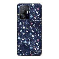 Xiaomi Mi 11T 5G Uyumlu Kılıf Utopia (36) Glitter Kılıf Kahverengi