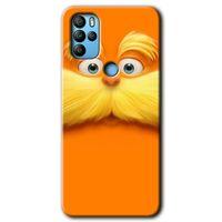 Potkal Hediye Fabrikası Omix X500 Kılıf HD Desen Baskılı Arka Kapak - Garfield