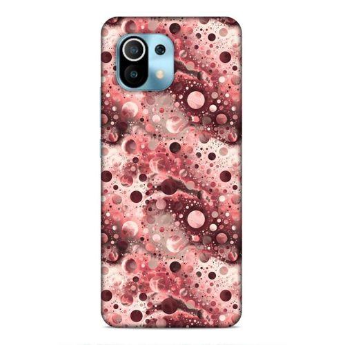 Xiaomi Mi 11 Uyumlu Kılıf Utopia (11) Tam Koruma Pembe