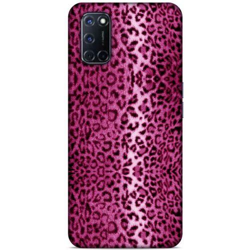Leopar Pembe Samsung Galaxy A80 Kılıf