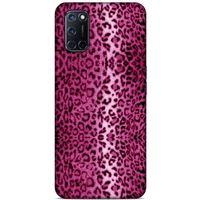 Leopar Pembe Samsung Galaxy A80 Kılıf
