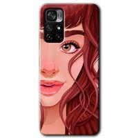 Xiaomi Redmi Note 11T Kılıf HD Desen Baskılı Arka Kapak + Temperli Cam - Kızıl Kız