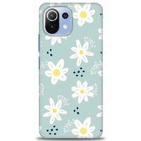 Xiaomi Mi 11 Lite Kılıf HD Baskılı Kılıf - Papatyalar + Tam Ekran Koruyucu