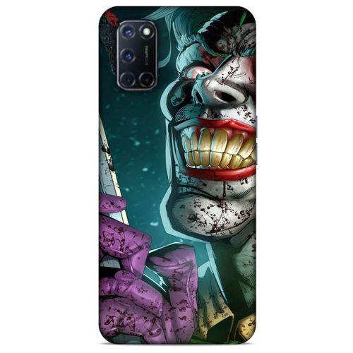 Oppo A92 Uyumlu Kılıf Joker (24) Darbe Emici Kılıf Bakır