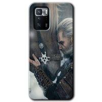 Potkal Hediye Fabrikası Poco x3 GT Kılıf HD Desen Baskılı Arka Kapak - Kadim Dost