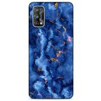 Realme 7 Pro Uyumlu Kılıf Mavi Delisi (7) Telefon Kılıfı Mermer