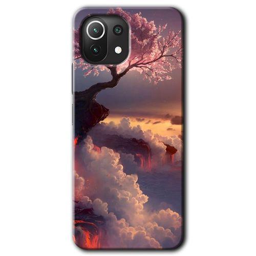 Xiaomi Mi 11 Lite Kılıf HD Desen Baskılı Arka Kapak - Uçurumdaki Hayat