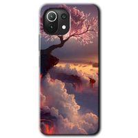 Xiaomi Mi 11 Lite Kılıf HD Desen Baskılı Arka Kapak - Uçurumdaki Hayat